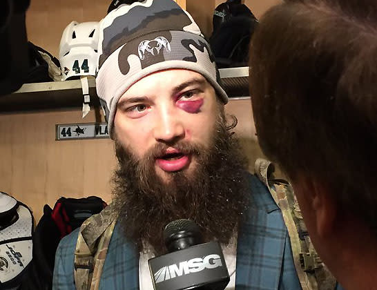 tremendous shiner after Columbus high-stick