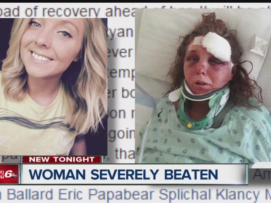 Der er en tendens pædagog Skrive ud Woman severely beaten, ex-boyfriend charged