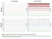 Moleculin Announces Presentation of Positive Data Demonstrating High Anti-Cancer Activity of Annamycin and Non-Cardiotoxic Properties