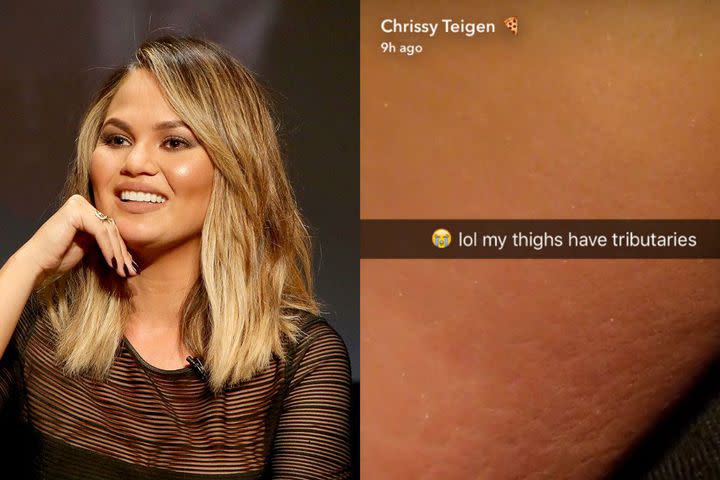 Chrissy Teigen Keeps It Real Jokes About Her Stretch Marks On Snapchat