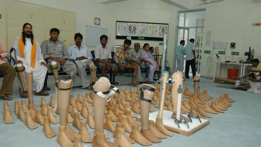 INDIA - SEPTEMBER 18:  View of the Jaipur Foot and Calipers , World's largest limb fitting society. The artificial limbs provided by Bhagwan Mahaveer Viklang Sahayata Samiti uses Jaipur Limb Technology in Sawai Mansingh Hospital, Jaipur, Rajasthan, India  (Photo by Purushottam Diwakar/The The India Today Group via Getty Images)