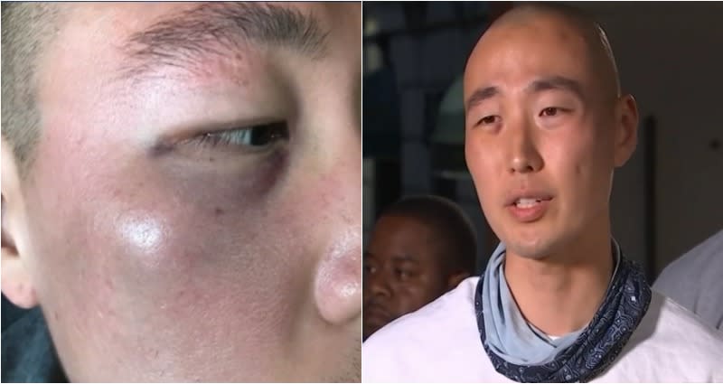 Defeated Air Force veteran, called the ‘Chinese virus’ in an unprovoked attack in Los Angeles’ Koreatown