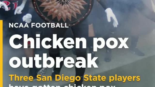 After 3 players get chicken pox, San Diego State hoping there aren't more cases