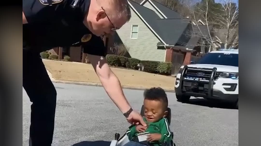 This police officer had the cutest interaction with a kid born with a rare  bone disease