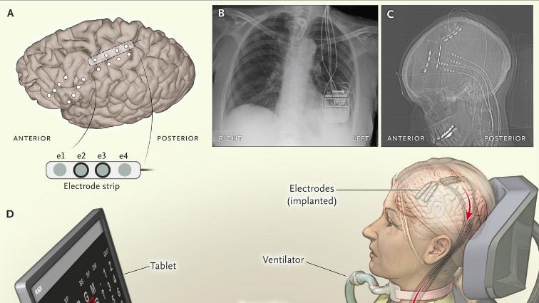 New England Journal of Medicine