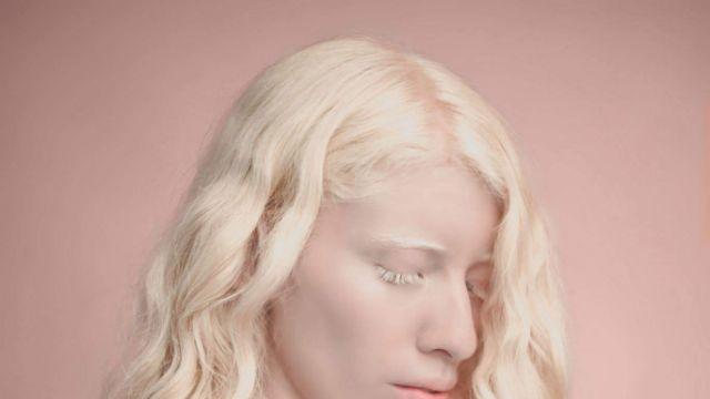 Ruby Vizcarra Albino Model