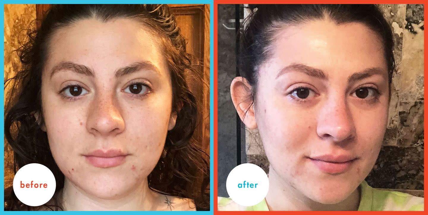 I Tried a PeriodBlood Face Mask and, Uh, You Definitely Shouldn’t