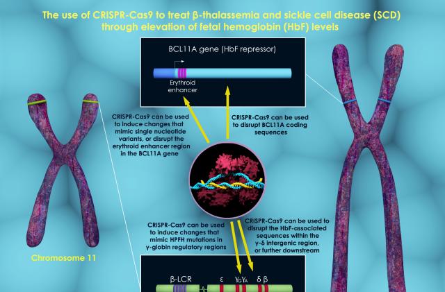 3d render that shows few possible ways to treat beta-thalassemia and sickle cell disease through increase in fetal hemoglobin (HbF) levels