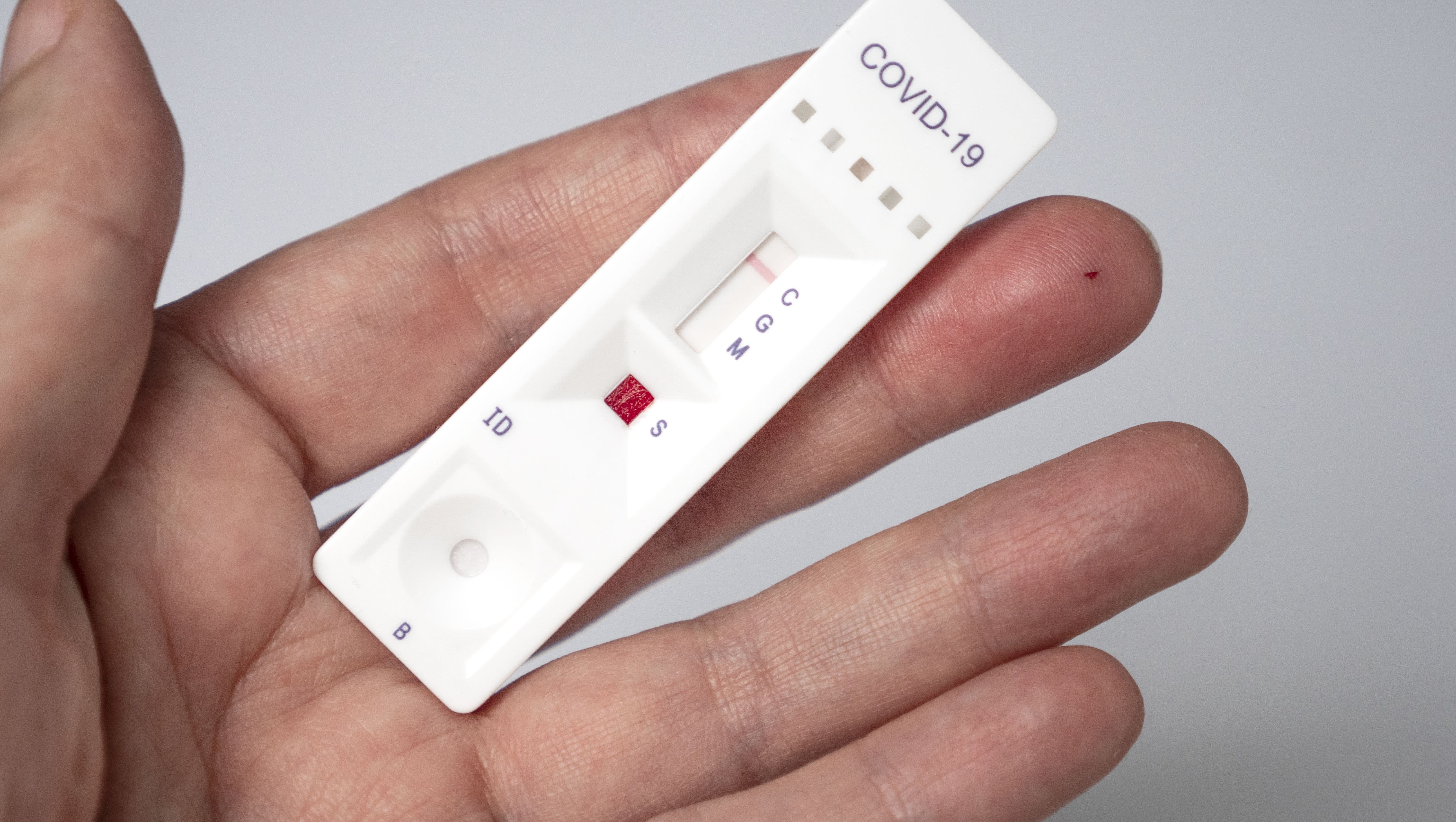 Everlywell's FDA-authorized COVID-19 test kit launches [Video]