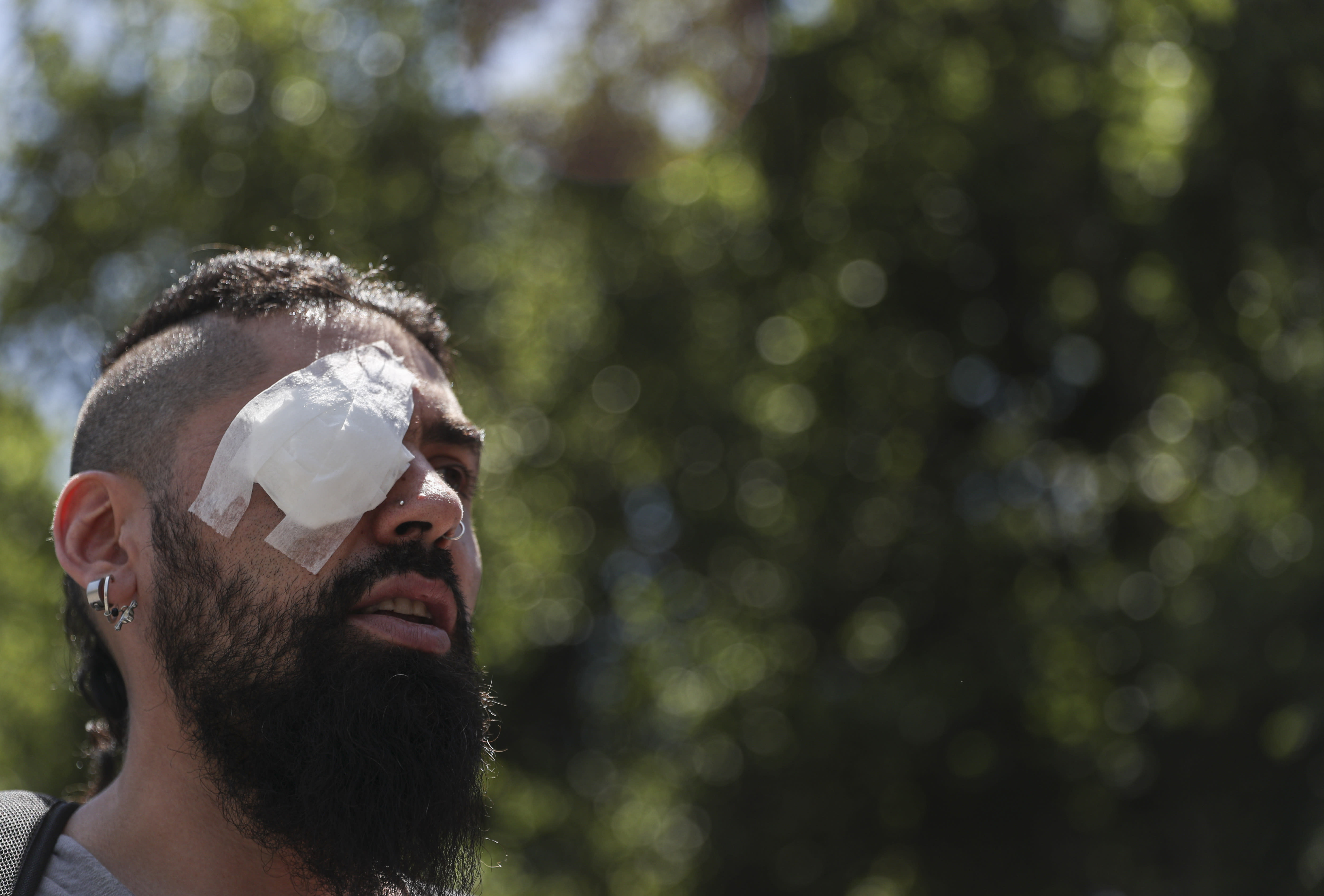 Marcelo Herrera, his eye bandaged from an injury he received during recent protests, takes part in a demonstration in support of protesters who have been injured in the eye by Chilean police, in Santiago, Chile, Thursday, Nov. 28, 2019. More than 230 anti-government protesters have suffered an eye injury since the social unrest began on Oct. 18. (AP Photo/Esteban Felix)