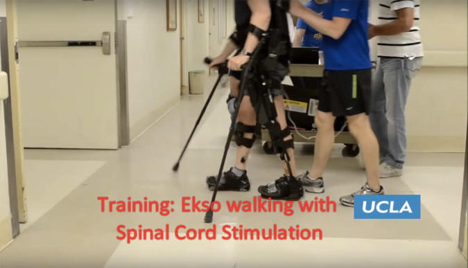 Robotic exoskeleton and zaps of electricity helped man walk again