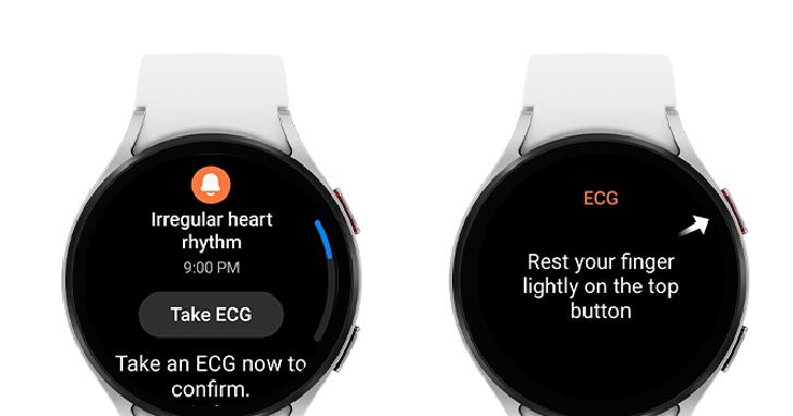 Galaxy Watch на Samsung скоро ще може да предупреждава потребителя си за неправилен сърдечен ритъм