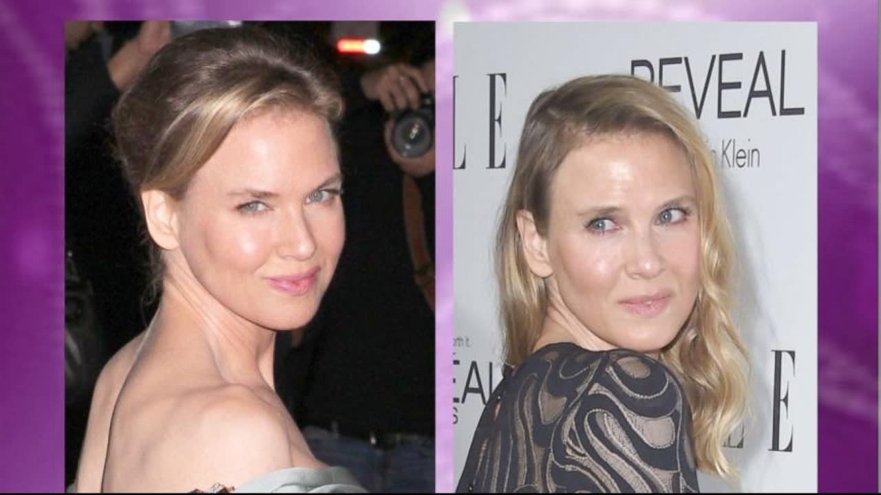 Renée Zellweger Is Glad That People Think She Looks Different