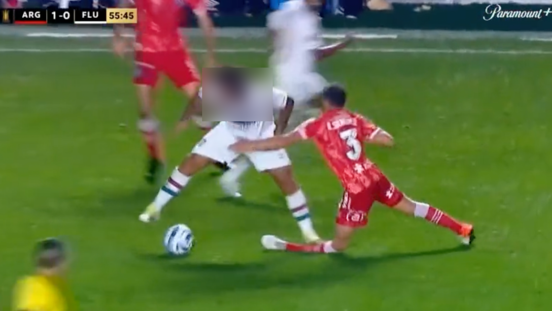 VIDEO Une star du foot provoque une blessure terrifiante en plein match,  des images qui font froid dans le dos...