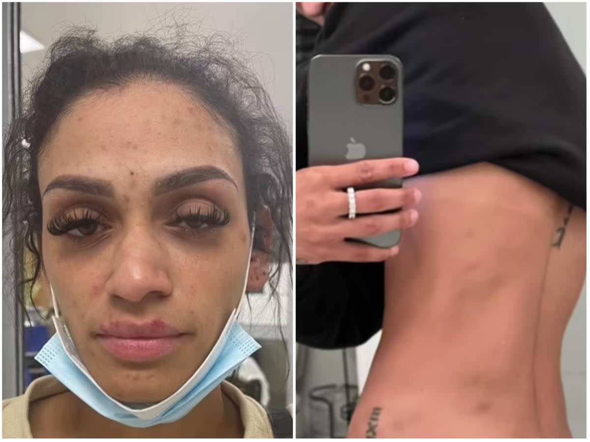 La femme d’un joueur de la NBA publie des photos de ses blessures après qu’il se soit rendu pour violence conjugale