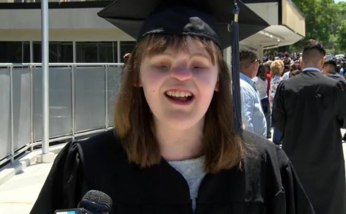 Girl Born Without Eyes Nose Graduates College