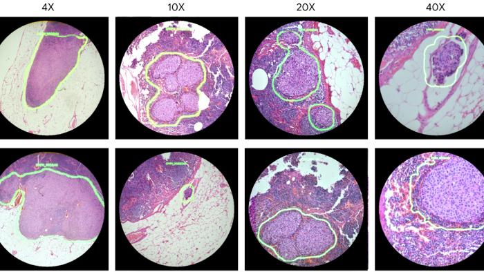 Image from Googles AI microscope