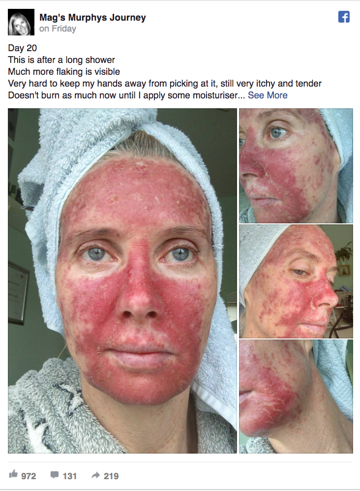 This Womans Skin Cancer Selfies Ha