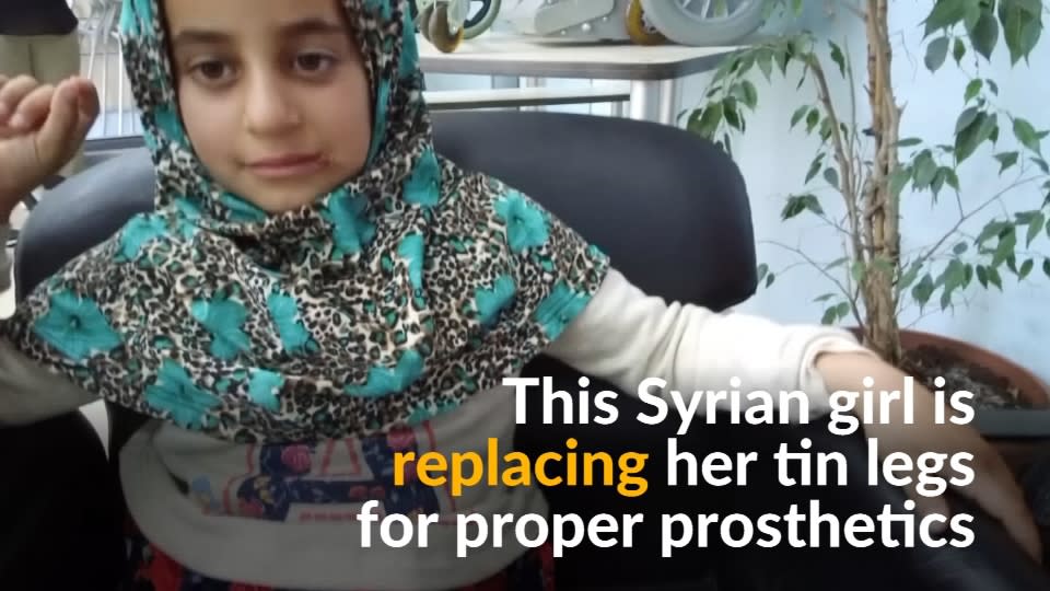 Disabled Syrian Girl Ditches Tin Legs For Prosthetics 