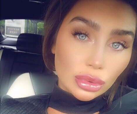 Towie star Lauren Goodger urged to stop having cosmetic work after posting  'unrecognisable' selfie