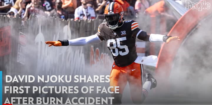 Cleveland Browns tight end David Njoku burned on face, arm in home accident  while lighting fire pit