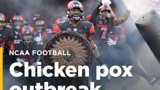 After 3 players get chicken pox, San Diego State hoping there aren't more cases