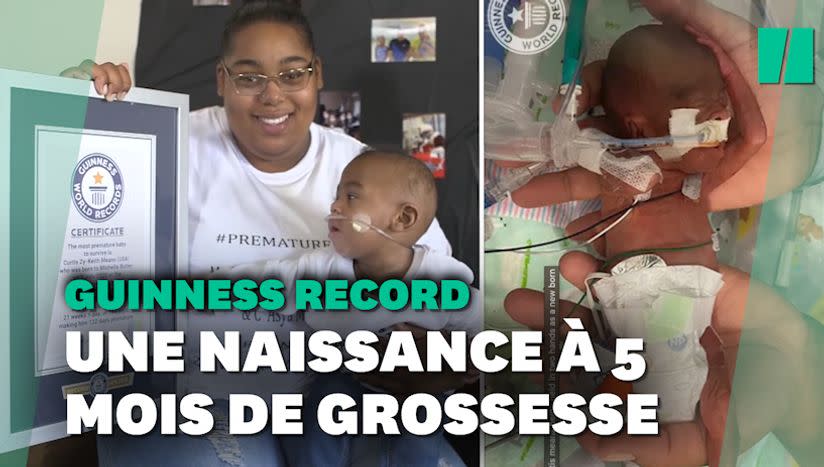 Aux Etats Unis Ce Bebe Est Le Plus Grand Premature Au Monde Apres 5 Mois De Grossesse