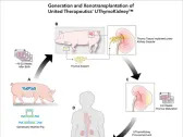 CORRECTING and REPLACING PHOTO United Therapeutics Announces World’s First Successful Xenothymokidney Transplant