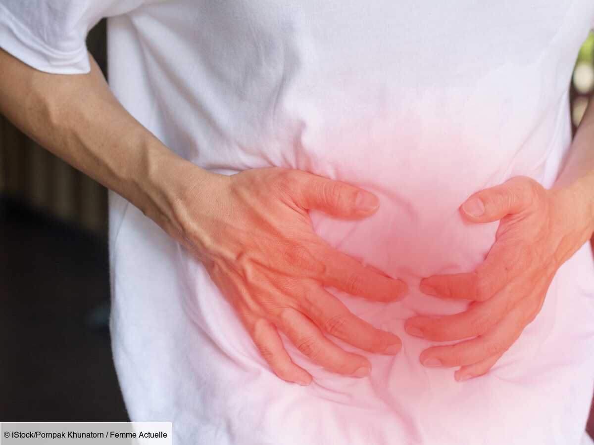 cause, symptom, treatment of this chronic inflammatory bowel disease (IBD)