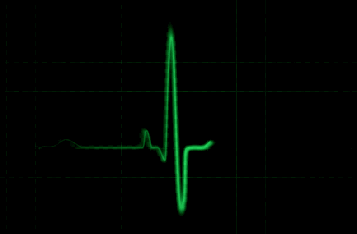 Сердце остановилось умер. ЭКГ на черном фоне. Кардиограмма гиф. Кардиограмма остановки сердца. Сердцебиение кардиограмма.