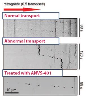 Annovis Bio Announces Positive Phase 2 Data Anvs401 Improves Cognition In Alzheimer S Disease Patients Cognition Improved 3 3 Points On Adas Cog11 - how to make the roblox death sound google translate