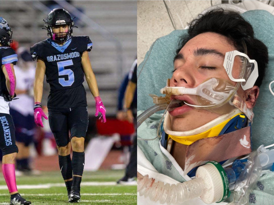 A Texas high school athlete was brutally beaten at a party with friends. Now his..