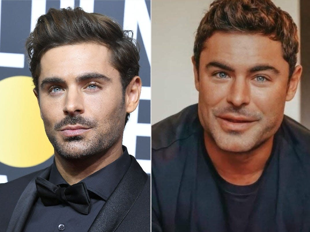 What's behind Zac Efron's 'new' cheeks and jawline, according to experts