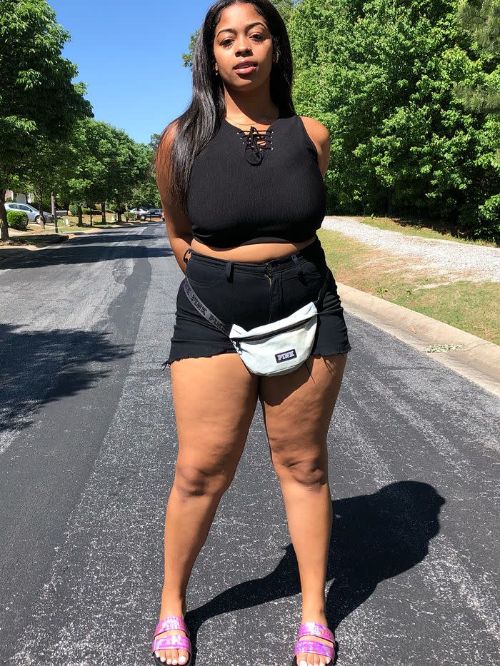 These 15 Images Of Real Women S Thighs Prove That Cellulite Is