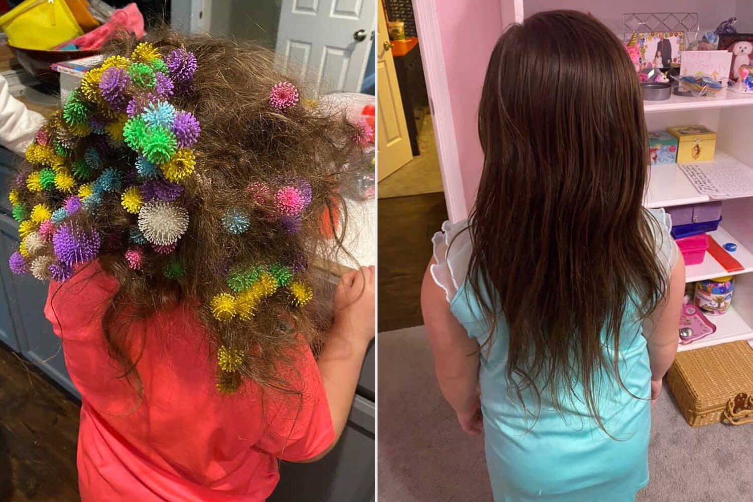 Mom spends 20 hours combing 150 velcro-like toys in the hair of a 6-year-old daughter: ‘Mom’s worst nightmare’