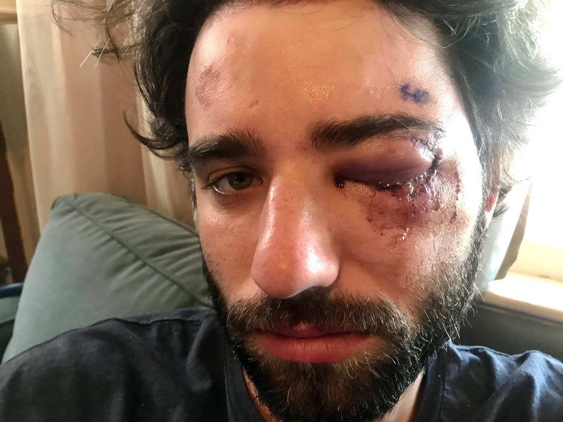 Protester who lost sight in one eye after being hit by projectile at KC protest sues