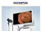 Olympus Announces Market Launch of EVIS X1™ Endoscopy System