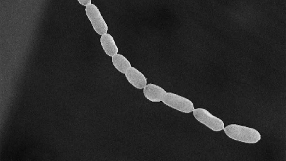 History bacterium uncovered as extended as human eyelash