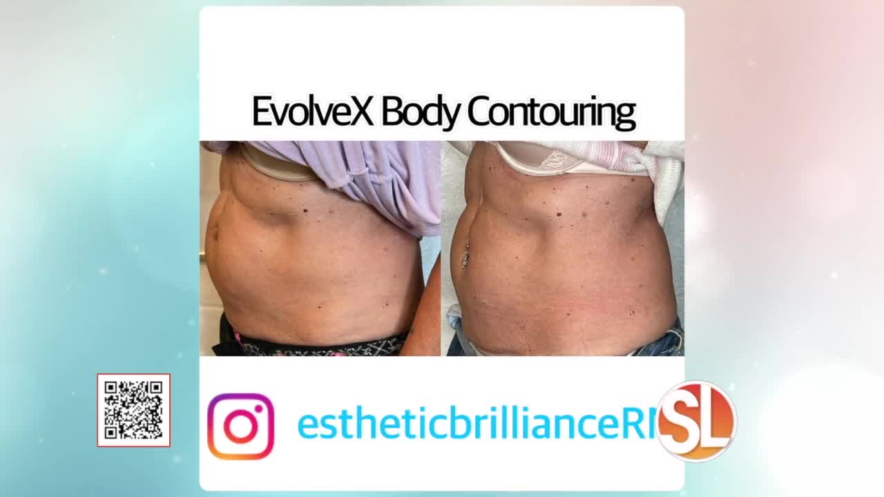 Body Contouring – Fantasy MedSpa