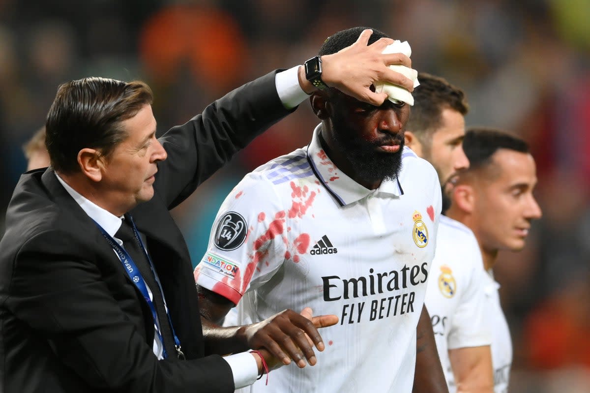 Champions League: Bloodied Antonio Rudiger grabs late Real Madrid point as  Kylian Mbappe nets amid fresh row