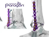 Paragon 28 Adds to Suite of Novel Syndesmosis Repair Solutions with Launch of Grappler® R3INFORCE™ Extraosseous Repair System