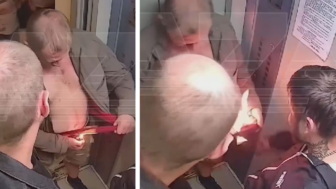 Drunk Russian man sets himself on fire to try remove his T-shirt