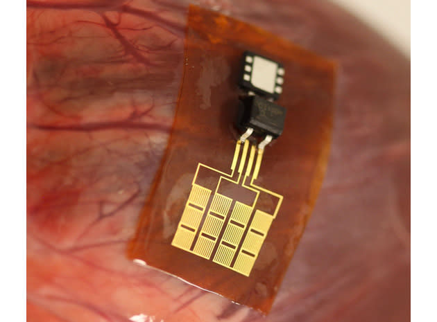 Tiny power plant can charge a pacemaker through heartbeats