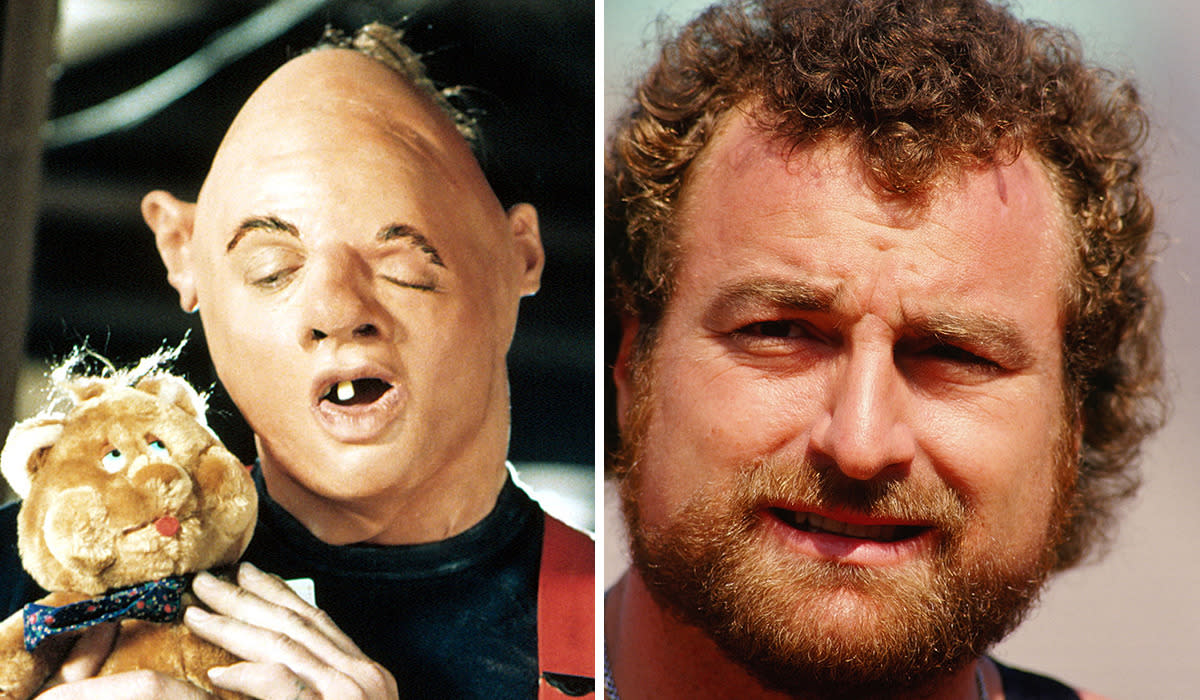 The Tragic Real Life Of Sloth From The Goonies