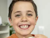 Align Technology Launches Integrated Consumer Campaign and #Invisisforkids to Drive Awareness of How the Invisalign® Palatal Expander System Is a Better Option for Expanding a Child’s Narrow Palate to Make Room for Adult Teeth