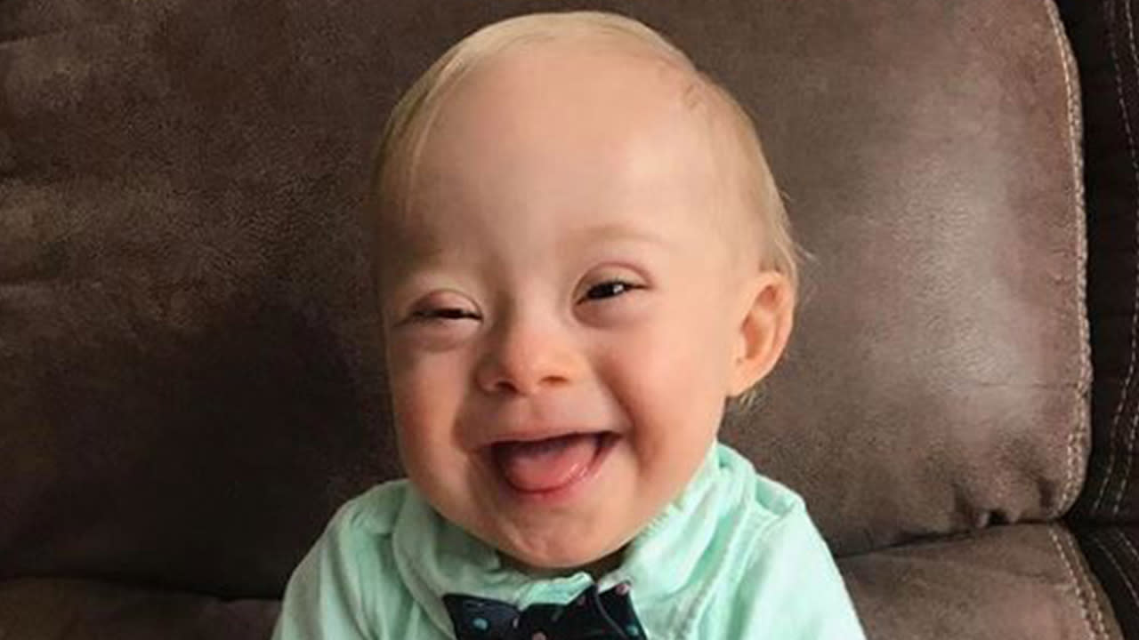 The Reason Why This Year's Gerber Baby Is Making HISTORY