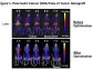 Monopar Announces Promising Preclinical Data for its MNPR-101 Radiopharma Program Targeting Advanced Cancers