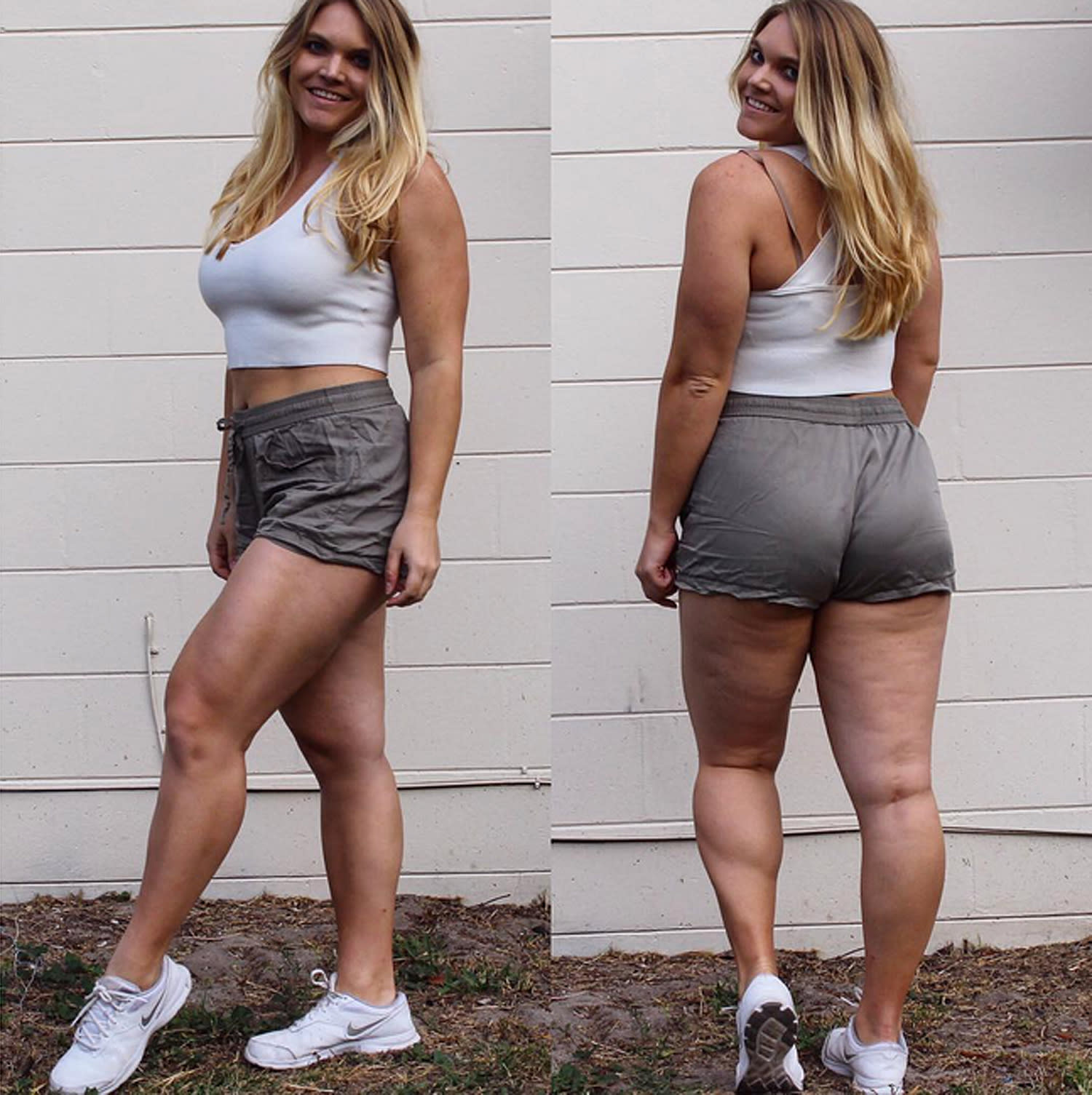 Body Positivity Advocate Proudly Displays Her Cellulite ‘you Are So