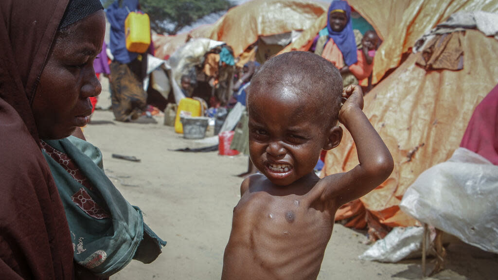 L’ONU dit qu’au moins 1 milliard de dollars sont nécessaires pour prévenir la famine en Somalie