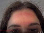 Wearing Apple's Vision Pro for 30 minutes put a big red mark on the forehead of WSJ's gadget reviewer